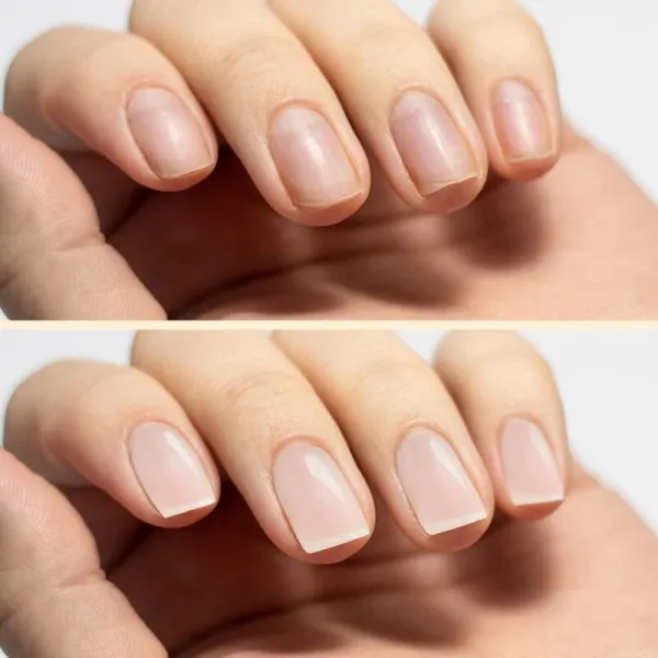 SOS Nail Regenerator PNB, 15 ml